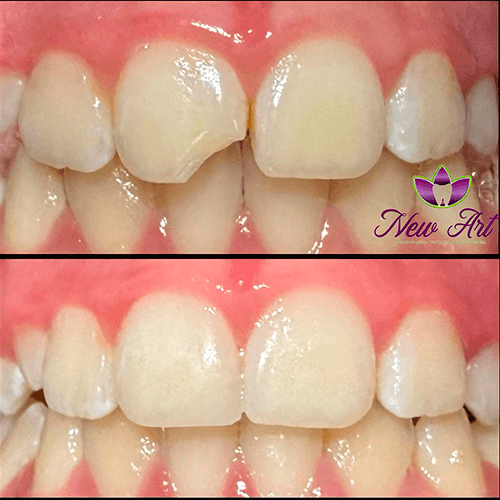 Dentística Restauradora